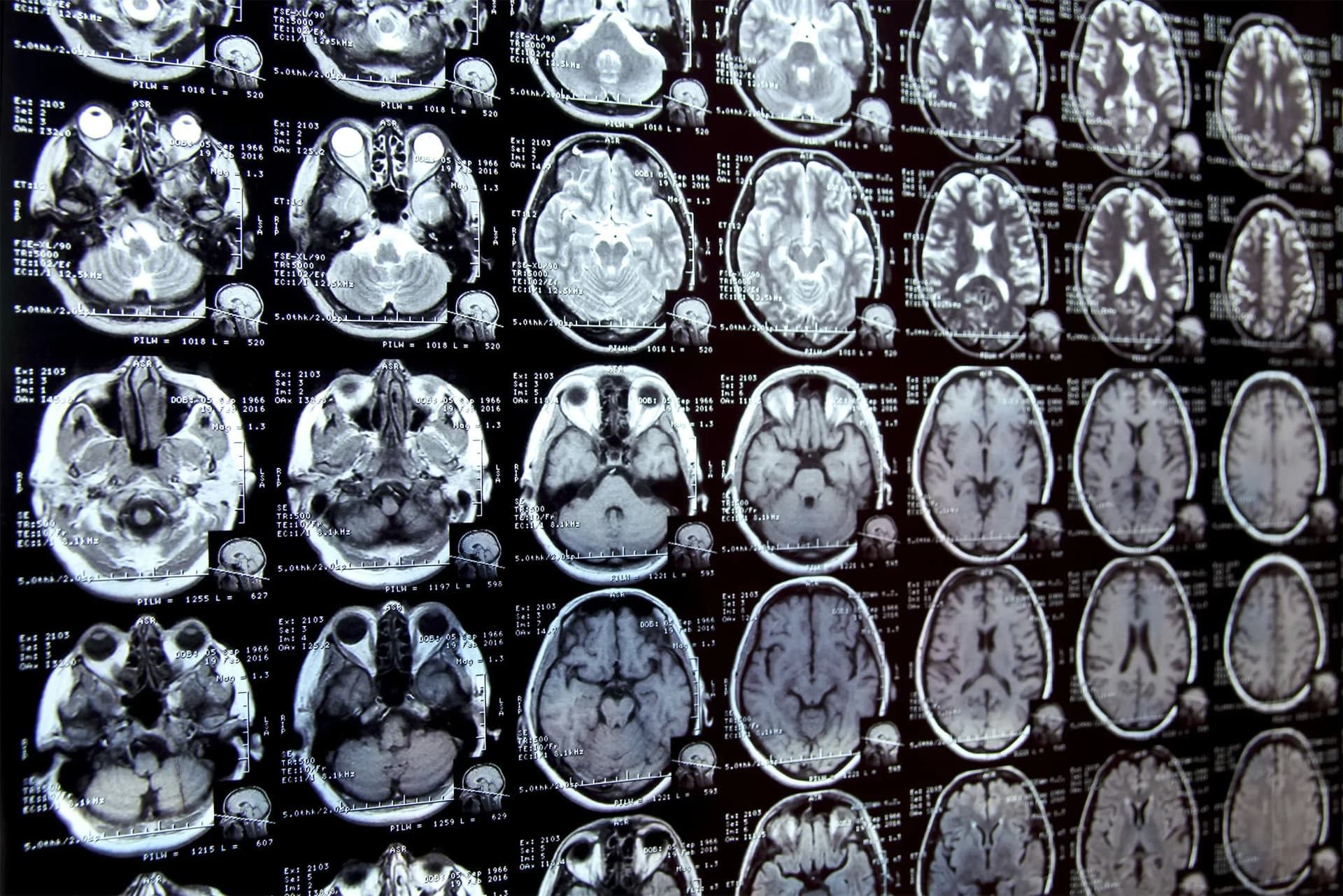 Інноваційна AI-система від MIT революціонізує сегментацію медичних зображень