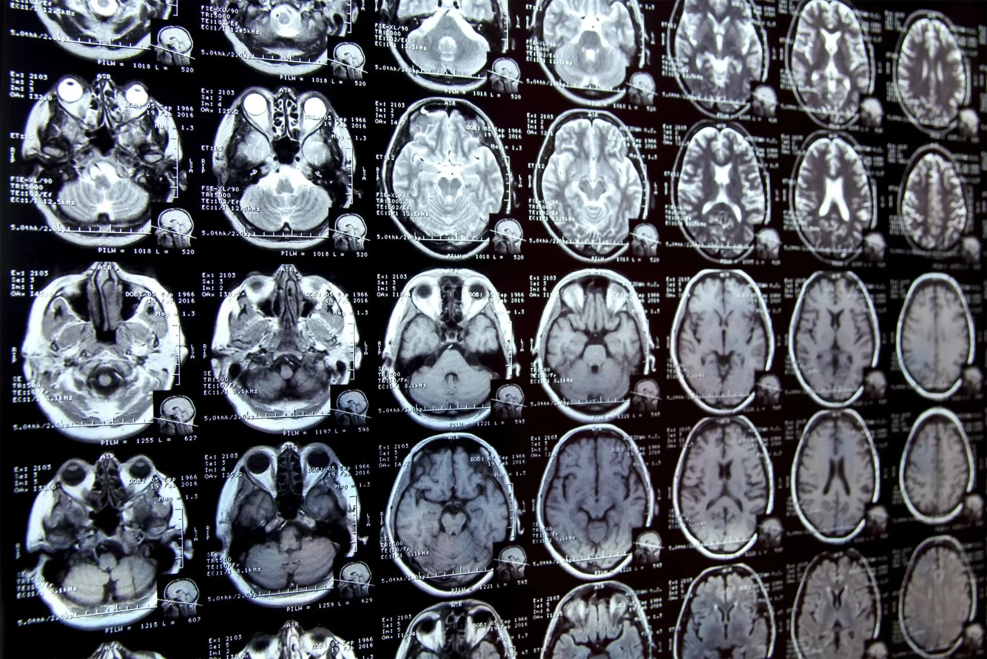 Інноваційна AI-система від MIT революціонізує сегментацію медичних зображень